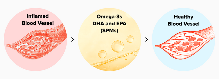 Illustration showing an inflamed blood vessel, omega-3s DHA and EPA (SPMs) in the center, and a healthy blood vessel, highlighting the benefits of omega-3s in improving blood vessel health.