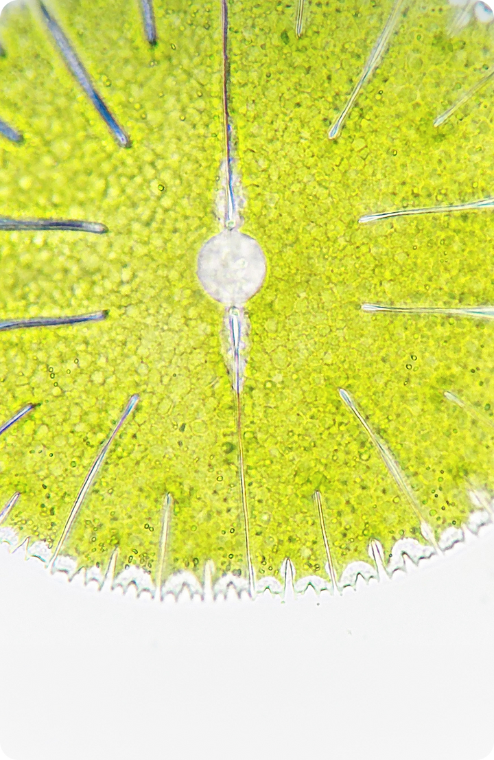 Close-up view of a green, round microscopic organism with radiating lines and spiky edges, possibly a type of algae or protist, under a microscope. Brightly lit with detailed cell structure visible.