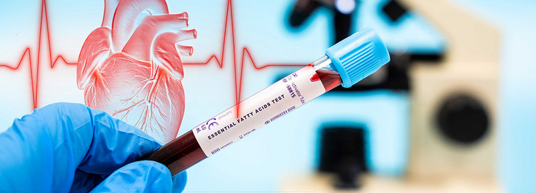 A gloved hand holds a blood sample tube labeled Essential Fatty Acids Test, with a heart illustration and ECG line in the background, and a blurred microscope visible.