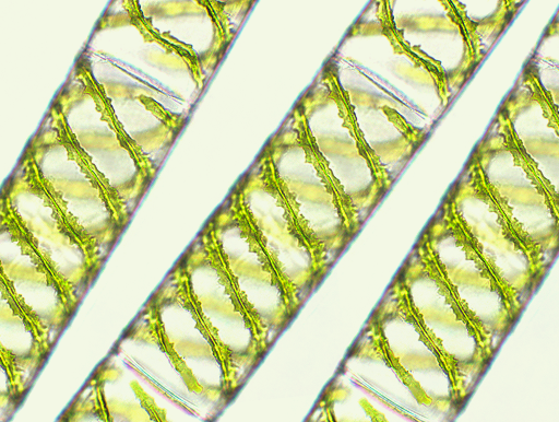 Microscopic view of bright green spiral-shaped algae, Spirogyra, showing helical chloroplasts inside transparent cylindrical cells, arranged diagonally across a light background.